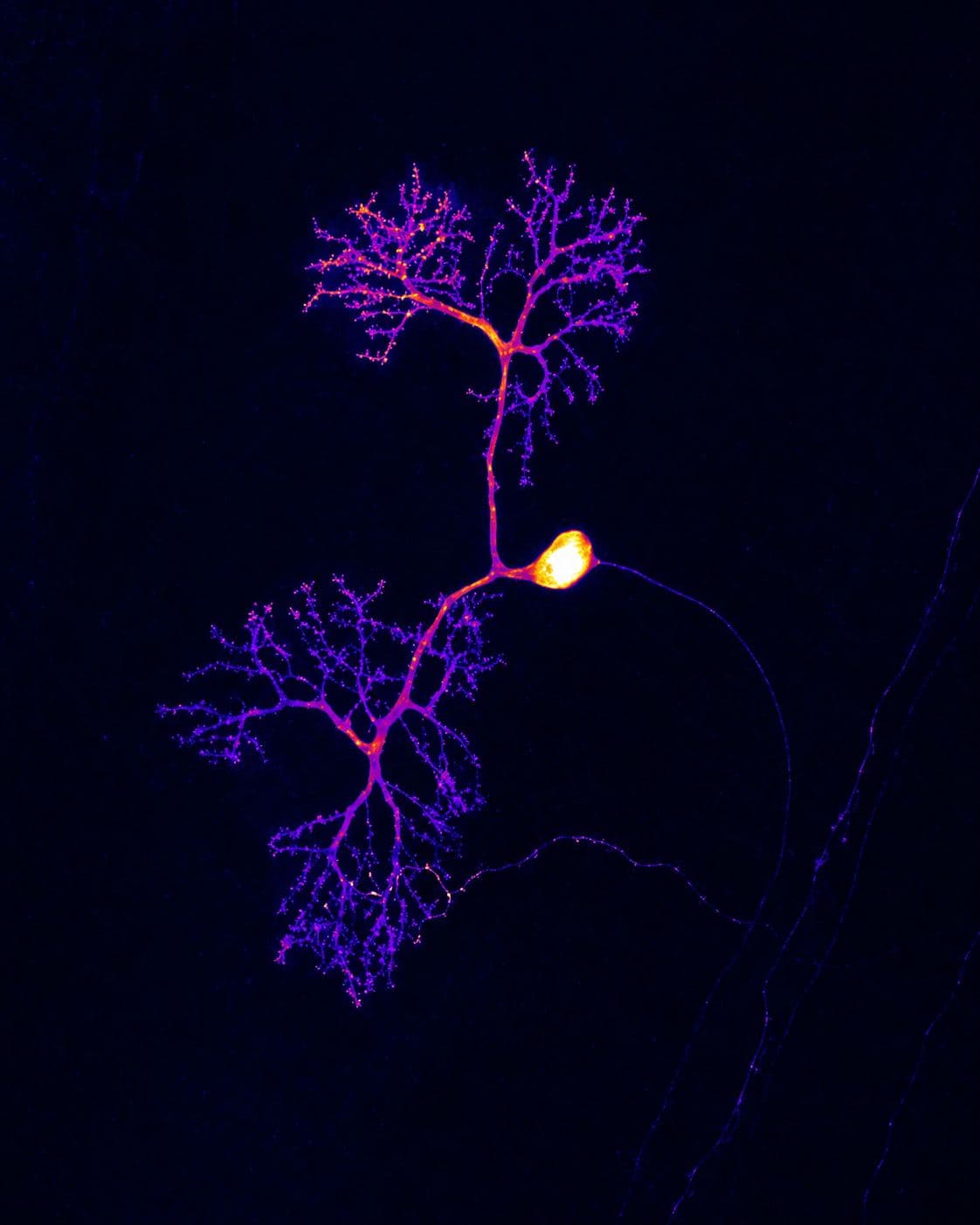 A microscope image of a branching nerve cell glowing purple against a dark background
